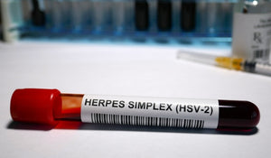 Ask Dr. NerdLove: My Friend Doesnt Tell Her Partners She Has Herpes. What Should I Do?